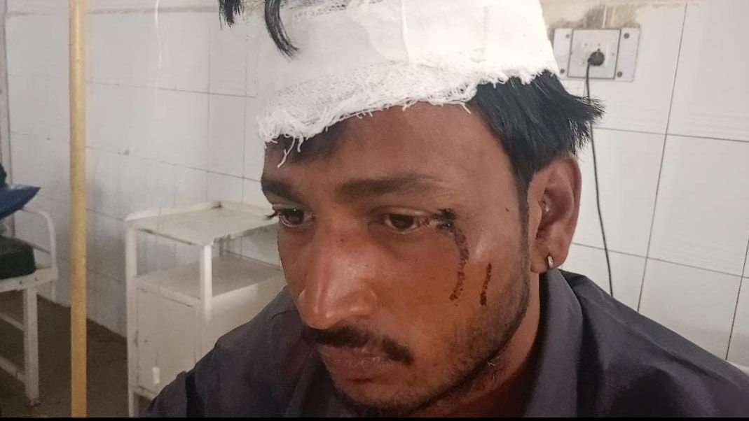 शिवपुरी में रूपये नहीं देने पर रंगदारी: बीयर से सिर फोडा, मनियर की घटना, शादी में शामिल होने गया था युवक / Shivpuri News