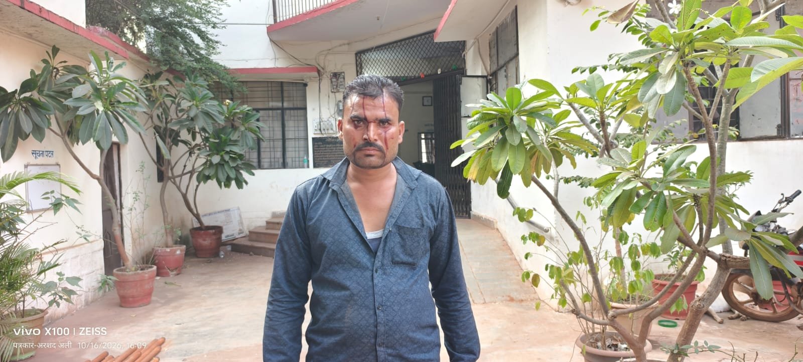 कट मारने की बात पूछने पर विवाद, लोडिंग वाहन में रखे सरिये से युवक के सिर पर हमला / Shivpuri News