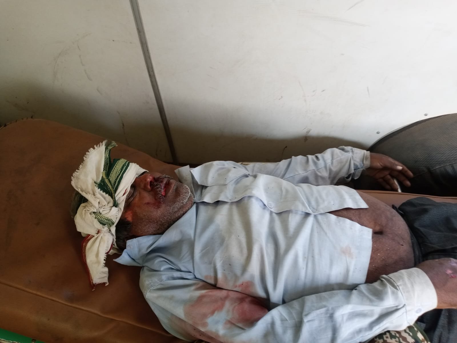 ग्राम ककरई में आधी रात जीप से पहुंचे लोगों ने पिता-पुत्र पर किया हमला, फायरिंग का भी आरोप; जिला अस्पताल में उपचार जारी / Shivpuri News