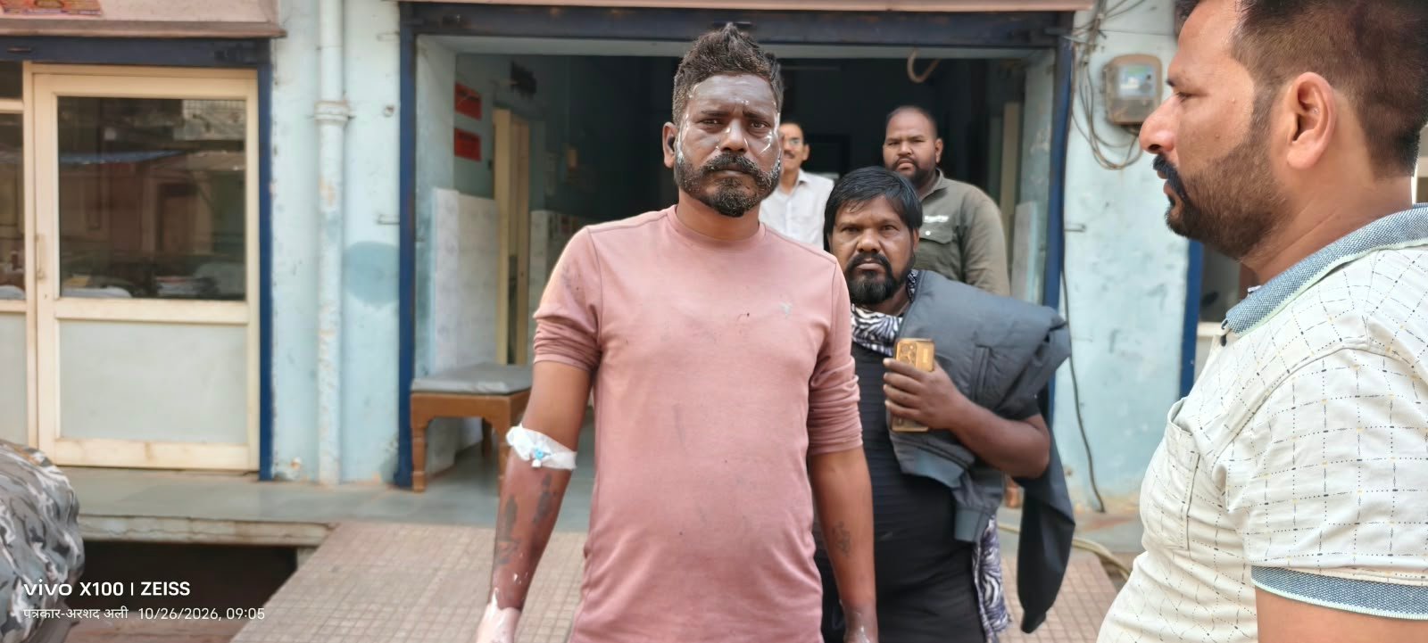 हनुमान कॉलोनी में डीपी पर काम करते समय करंट से झुलसा विद्युत कर्मचारी, निजी अस्पताल में भर्ती / Shivpuri News