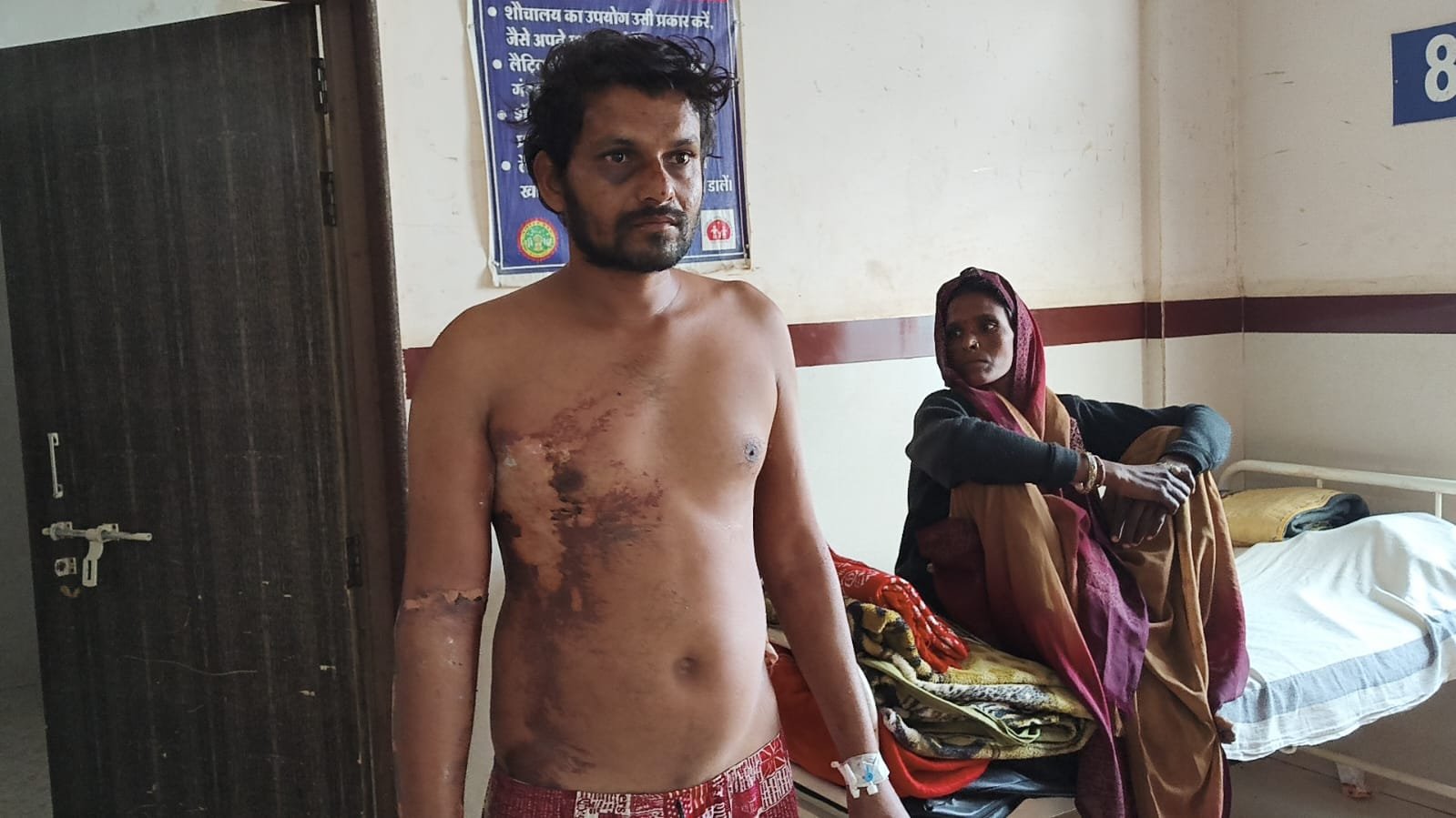 खेत से चारा लेकर लौट रहा युवक 33 केवी बिजली लाइन की चपेट में आया, गंभीर रूप से झुलसा / Shivpuri News